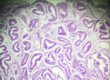 Dr Amer Raza - Understanding the Differences Between Adenomyosis and Endometriosis