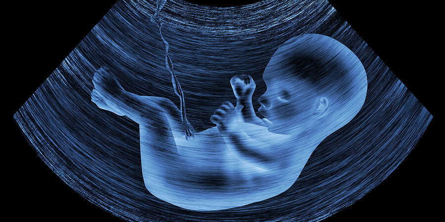 Ultrasound Baby